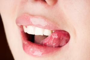 Spröde Lippen lassen sich mit gezielter Lippenpflege vermeiden